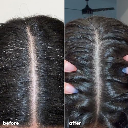 Coco & Eve Clarifying Detox Shampoo. Remove Hard Water and Product Build Up. With Safe And Nonstripping 280 Ml