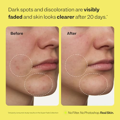 Peach Slices Super Fade Discoloration Serum For Face Dark Spots Hyperpigmentation Uneven Skin Ation Serum For Face 1.01 Oz