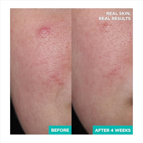 Aestura ACica365 Soothing Repair Gel Cream Moisturizer With Centella Asiatica + Panthenol