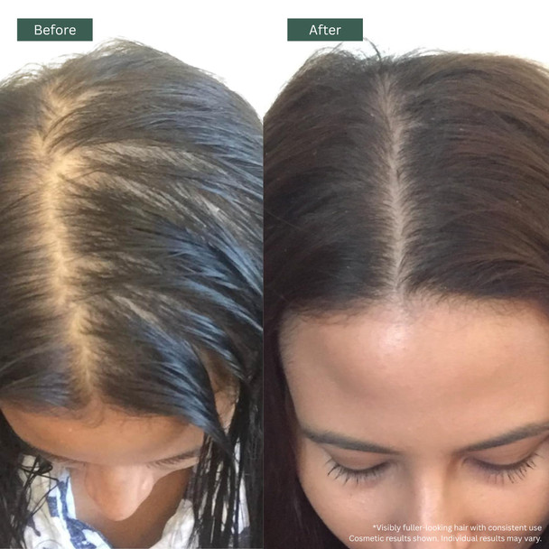 Regrowz Natural Hair Oil 3 X Rosemary Hair Growth Oil With Argan 4.06 Fl Oz