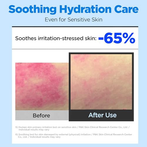 Wellage Real Hyaluronic Soothing Cream 100 Pure Hyaluronic Acid Korean Face Moisturizer 2.7Oz