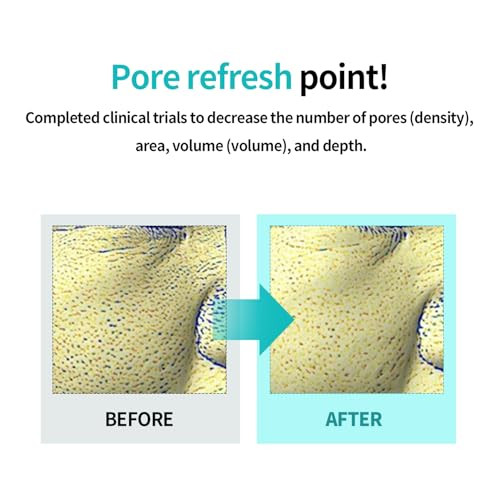 Ilso Moringa Tightening Pore Serum + Dual Cooling Master