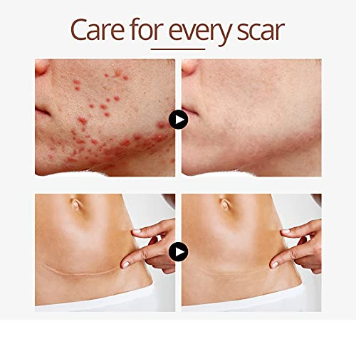 Beauty Mall Crocodile Repair Serum Anti Scar Oil With Herbal Extract Activate Cell 15Ml 1Pc
