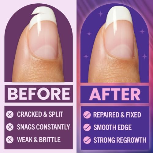 Finga-Nails Nail Repair Kit Fix Broken Or Damaged Nails With Silk Wrap