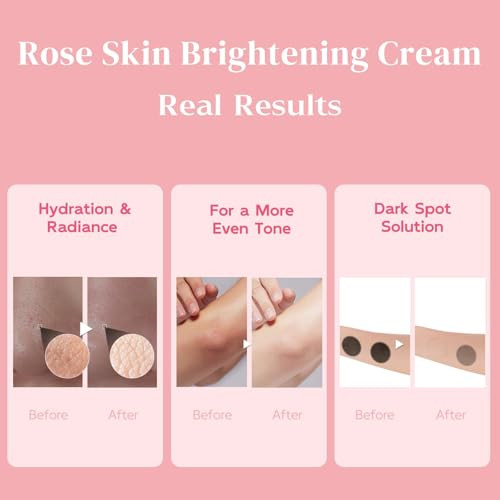 Beliarst Skin Bleaching Cream For Inner Thigh Armpit Dark Elbows And Knees 1.69 Fl.Oz
