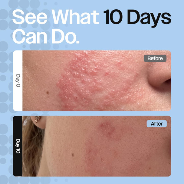 CELRIV Barrier Repair Cream for Dry Sensitive & Eczema Prone Skin Oncology Friendly +300% Hydration Lightweight Non Greasy 24HR Moisturizer