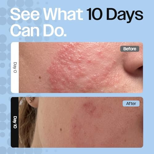 CELRIV Barrier Repair Cream for Dry Sensitive & Eczema Prone Skin Oncology Friendly +300% Hydration Lightweight Non Greasy 24HR Moisturizer