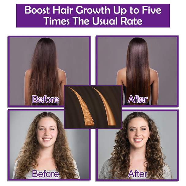 Frownies Hair Growth Shampoo and Conditioner Set With Rosemary  Biotin Argan and Castor Oils for Thinning Damaged Curly Hair