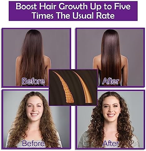 Frownies Hair Growth Shampoo and Conditioner Set With Rosemary  Biotin Argan and Castor Oils for Thinning Damaged Curly Hair