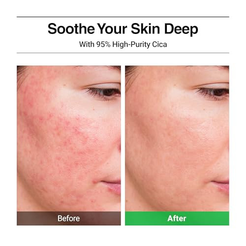 Wellage Real Cica Calming Trouble Ampoule Korean Skincare Soothing Serum Madecassoside Centella 1.69 Fl.Oz