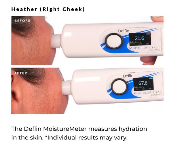 NassifMD 3HA Instant Hydrating Facial Mist - Contains 3 Types of Hyaluronic Acid to Keep Your Face Refreshed and Hydrated, Decreases Look of Skin Puffiness, Dark Circles and Fine Lines - 4 Fl Oz