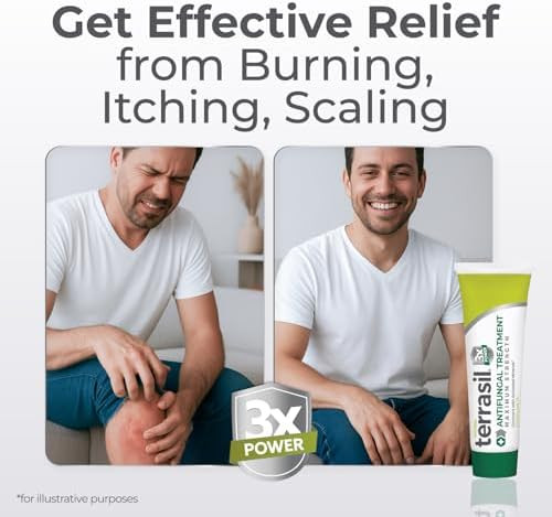 Terrasil Clotrimazole Antifungal Cream Maximum Strength Treatment Fungal Yeast Infection Athletes Foot Jock Itch Ringworm Natural Ingredients Anti Fungal Treatment for Skin and Feet