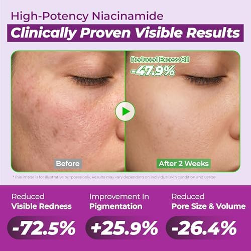 JUMISO 10% Niacinamide Dark Spot Serum for Uneven Tone, 1.01 fl oz | Water-gel for dark spots, uneven tone & oily skin. Zinc PCA refines pores; beginner-friendly, layers under makeup.