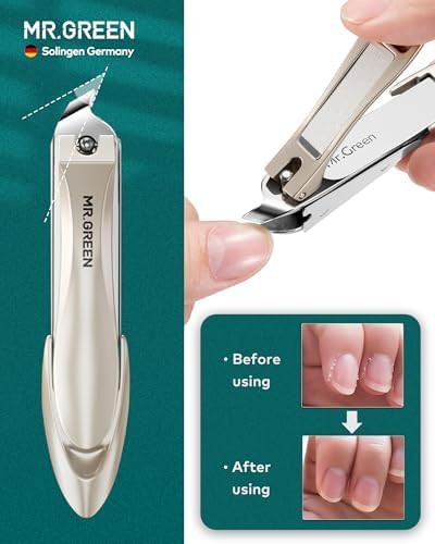 MR.GREEN 4Pcs Nail Clipper Set, Anti-Splash Upgraded Nail Clippers Kit | German Stainless Steel, Nail File+Tweezers Included, Unique Catcher, Exquisite Leather Case, for Men Women Home Travel Gift