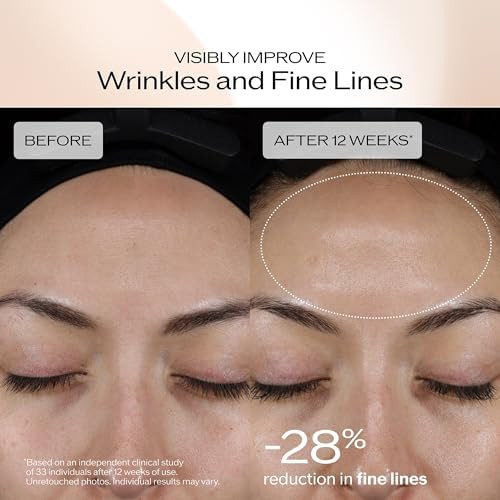 Shiseido Benefiance Dark Spot and Wrinkle Smoothing Face Serum - Visibly Improves Dark Spots & Wrinkles with Niacinamide & Plant-Based Retinol - 8HR Hydration - Non-Comedogenic, All Skin Types