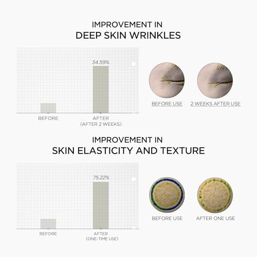 SKIN1004 Retinol 0.2% Boosting Shot Ampoule, Face Serum for Skin Elasticity, Facial Spicule Serum with Retinol & Retinal, Centella Ampoule for Fine Lines & Firmness, Korean Skin Care, 1.01fl.oz / 30ml