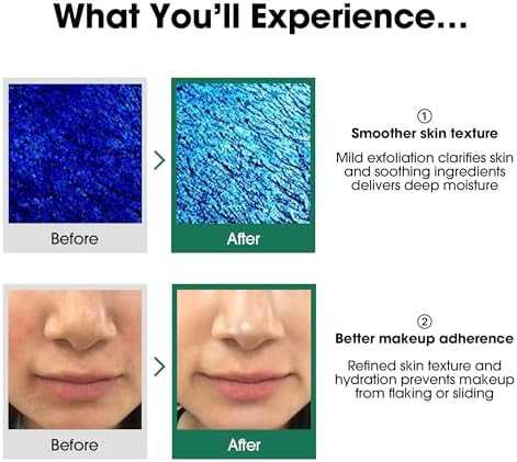SOME BY MI AHA BHA PHA 30 Days Miracle TonerKorean Refining Face Toner for All Skin Types  Daily Pore Care and Oil Control with 2% Niacinamide  Korean Skin Care