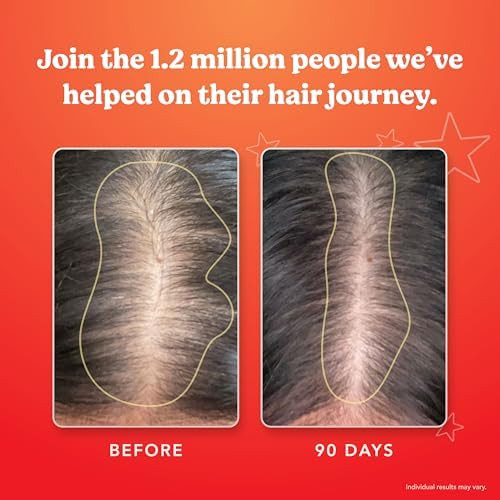 HAIRtamin MOM Prenatal and Postnatal Hair Vitamins