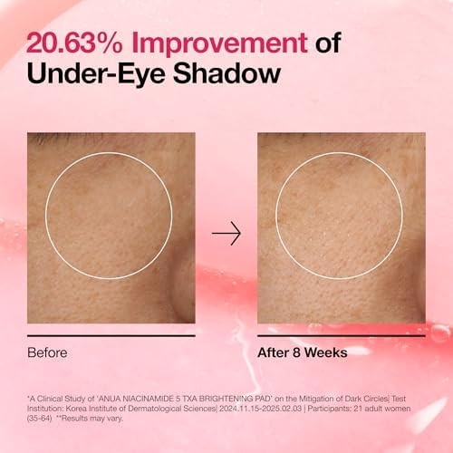 Anua Niacinamide 5 TXA Toner Pads, 60 Pads | Daily Facial Pads, Under Eye Brightener with Tranexamic Acid & Pink Vitamin, Hydration & Spot Care for Hyperpigmentation