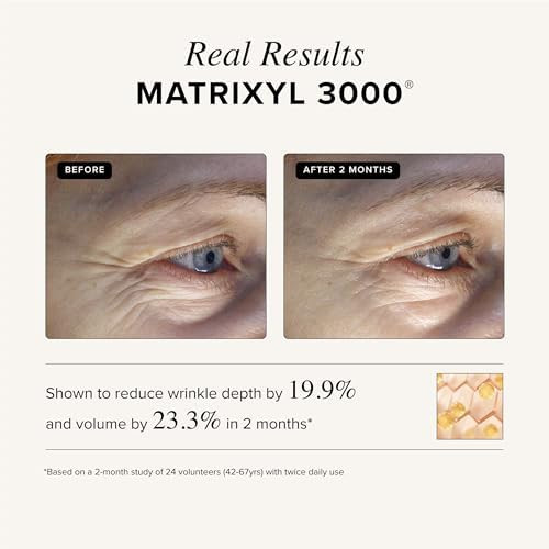 Asterwood Triple Repair Peptide Serum Matrixyl 3000 Argireline and Vit C Minimizes Fine Lines and Stimulates Collagen Formulated with Hyaluronic Acid Cruelty Free