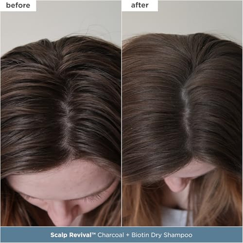 Briogeo Scalp Revival Scalp Care Essentials Setdetox And Hydrate Your Scalp With Charcoal plus Tea Treeinfused Treatmentsvegan And Cruelty