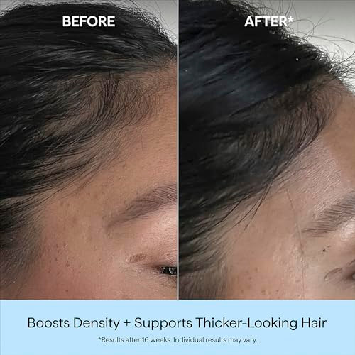 Briogeo Destined For Density Caffeine plus Biotin Peptide Density Serumincreases Hair Thickness And Volume For Fine Or Thinning Hairfastabsorbing And Nongreasyfragrancefreevegan And Crueltyfree