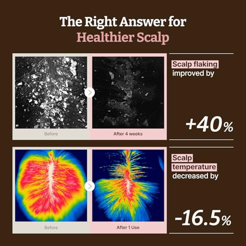 Dr.RejuAll Dr.Rejuall Advanced Pdrn Hair Density Scalp Serum Korean Scalp Skincare For Healthy Scalp And Root Volume With Exosome And Soyact Scalp Scrub Care For Flakeprone Hair 0.5 Fl Oz