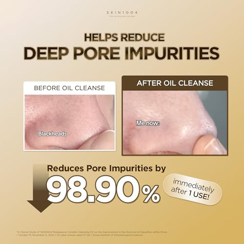 Skin1004 Madagascar Centella Light Cleansing Oil 200Mlgentle Oil Cleanser For Face Korean Facial Cleanser Double Cleansing 6.76 Fl.Oz