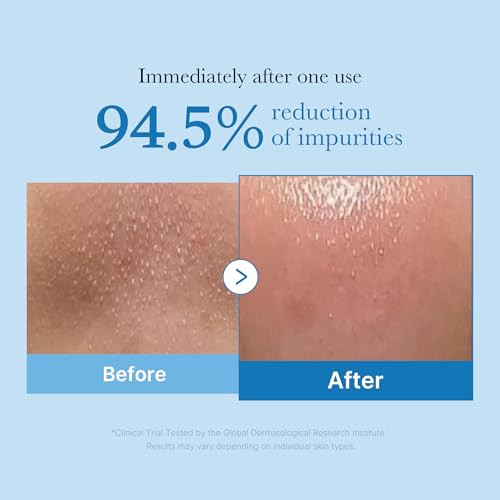 Medicube 3Step Zero Pore Care Trio Zero Pore Blackhead Cleansing Oil Zero Pore Mud Mask And Multi Pore Brush And Mask Applicatorallinone Blackhead And Excess Sebum Facial Care Routine