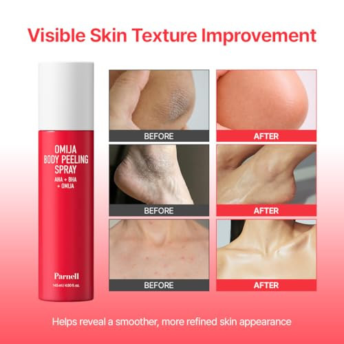 Parnell Aha Omija Body Peeling Spray And Cicamanu Body Miststrawberry Bumpy Skin Treatmentideal For Sensitive Troubled Skin Body Acne Spray Norinse Kbeauty Formula