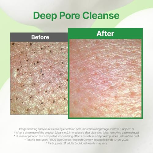 Makep:Rem Make Prem Pdrn Milk Essence Bubble Cleanser 145Mlmilk To Foam Daily Cleanser For All Skin Types Korean Face Wash 4.90 Fl.Oz.