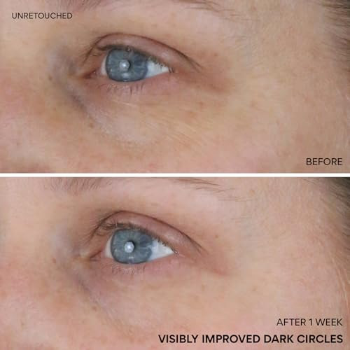 Innisfree Vitamin C Niacinamide Eye Serumkorean Eye Serum To Improve Dark Under Eye Circleseye Roll On Serum For All Skin Types