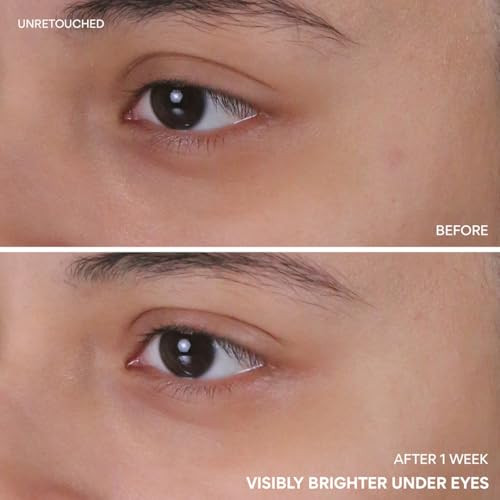 Innisfree Vitamin C Niacinamide Eye Serumkorean Eye Serum To Improve Dark Under Eye Circleseye Roll On Serum For All Skin Types