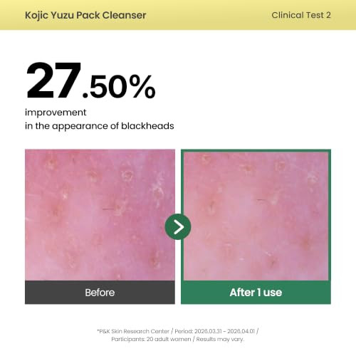AxisY Axisy Kojic Yuzu Pack Cleanser Facial Wash And Face Mask All In One As Blackhead Remover Pore Minimizer And Exfoliator For Brightening And Hydrating Vegan Korean Skin Care Facial Cleanser 2.11 Oz.