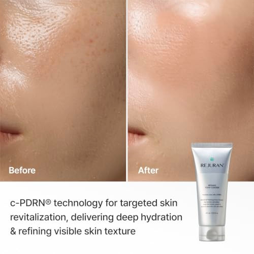 Rejuran Refining Foam Cleanser Cpdrn Hydrating And Gentle For Smoother Clearer Skin Minimizes Pores And Balances With Hyaluronic Acid And Tanin Complex Korean Skin Care 4.05 Fl Oz