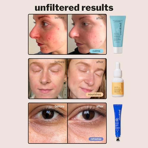 Cocokind Hydration Heroes Setmilky Ceramide Hydrating Serum Eye Cream With Cooling Metal Applicator Tip Lightweight Electrolyte Moisturizerhydrate Depuff Calm Balance3 Count