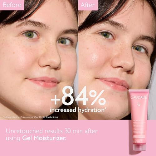 Caudalie Vinohydra Gel Moisturizer With Hyaluronic Acid And Aloe Vera 60 Mllightweight Noncomedogenic Moisturizer With Refreshing Gel Texture Hydrates Leaving Skin Instantly Dewy And Supple.