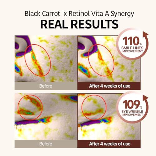Goodal Black Carrot Retinol Cream Beginner Friendly Korean Skin Care Moisturizer With Retinol Niacinamide Pore Minimizer 48H Lasting Hydration Antiaging Daily Cream 1.69 Fl.Oz 50Ml