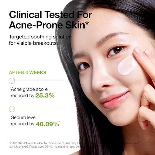Anua Azelaic Acid Cica Skin Soothing Moisturizer Lightweight And Redness Relief For Acne Prone Skin Fragrance Korean Skincare 3.38 Fl Oz