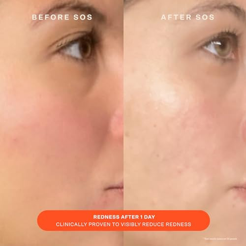 Tower 28 Sos Skin Care Set Balancing Gel Cleanser plus Barrier Recovery Cream Soothing Face Wash For Sensitive Skin plus Hydrating Face Moisturizer With Hyaluronic Acid 150 Ml 1.86 Oz 2 Count