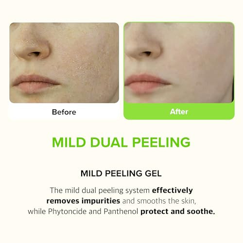 Klavuu Peeling Gel Gentle Exfoliator For Smooth Radiant Skin 2.71Ozhydrating Facial Peel Dual Peeling Jeju Hinoki Cypress Water Dead Skin Remover Sensitive Skin Daily Use