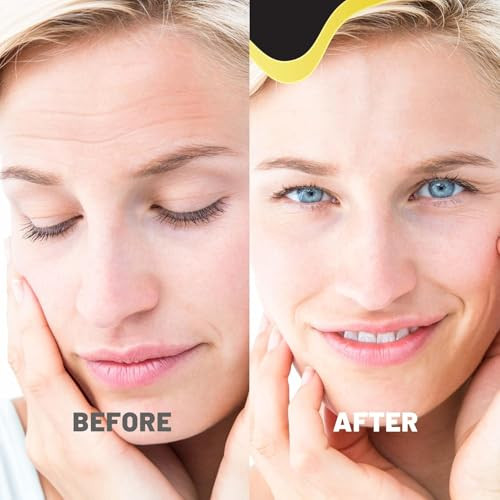 Tolevita Forehead Wrinkle Patchesforehead Lines Removerantiwrinkle Patches For Smoothing Fine Lines With Hydrogel Aloe Extract Collagen Vitamin E For All Skin Types 12 Pcs