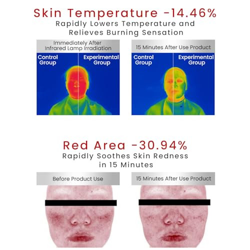 Winona Collagen Sheet Mask For Sensitive Skin Soothing Freezedried Mask With Solvent Visibly Reduces The Look Of Redness 6Pcs