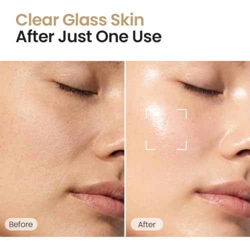 Skinfood 1957 Skinfood Rice Serum 48 Hours Fermented Rice Water Skincare Korean Serum For Face Korean Rice Skincare For Natural Glow Skin Pore Minimizer Rice Water Bright 55Ml 1.86Fl.Oz.