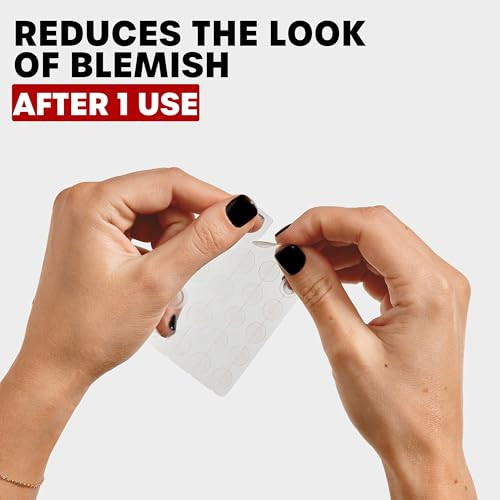 Thayers Invisible S.O.S Hydrocolloid Acne Pimple Patch Ultrathin Design Instantly Reduces Look Of Blemishes Set Of 22 Pimple Patches