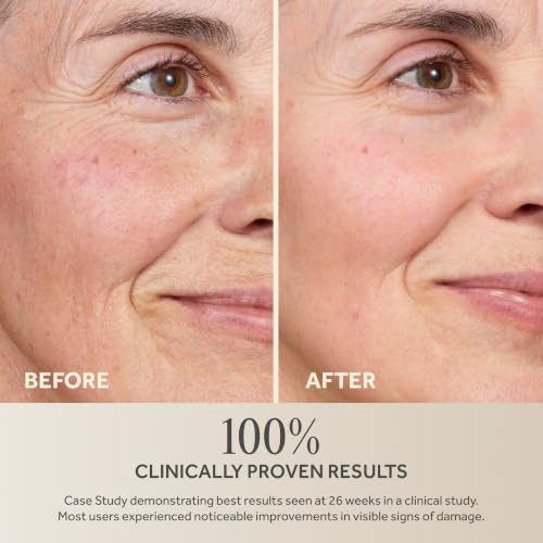 No7 Future Renew Damage Reversal Night Serum Antiaging Peptides Serum For Face Formulated With Hyaluronic Acid And Niacinamide To Help Reverse Visible Signs Of Skin Damage Overnight 0.84 Fl Oz