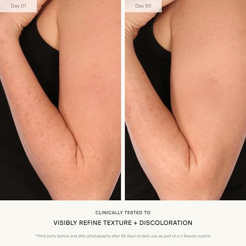 U Beauty Resurfacing Body Compound Firming Aha And Retinol Serum Phytic Lactic And Glycolic Acids Tackle Keratosis Pilaris And Uneven Texture Shea Butter And Papain For Hydrated Soothed Skin 6.7 Fl Oz