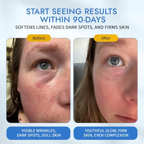 Maelove Moonlight Advanced Retinal Super Serum 10X Stronger Than Regular Retinol For Softening Lines And Wrinkles Reducing Dark Spots Improving Skin Firmness Vegan Crueltyfree retinaldehyde Serum 10X Stronger 1.0 Fl Oz 1.0 Fl Oz