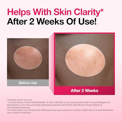 Anua Niacinamide 10 plus Txa 4 Serum Dark Spot Care Hyaluronic Acid Tranexamic Acid Lightweight And Hydrating Allinone Daily Facial Serum For Skin Korean Skincare 1.01 Fl.Oz