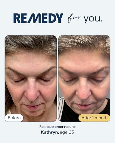 Remedy Science Remedy For Healthy Aging Serum For Wrinkles Uneven Texture And Tonewith Retinal Resveratrol Glycolic Acid Argireline Ferulic Acid Matrixyl 3000 By Dermatologist Dr. Shah